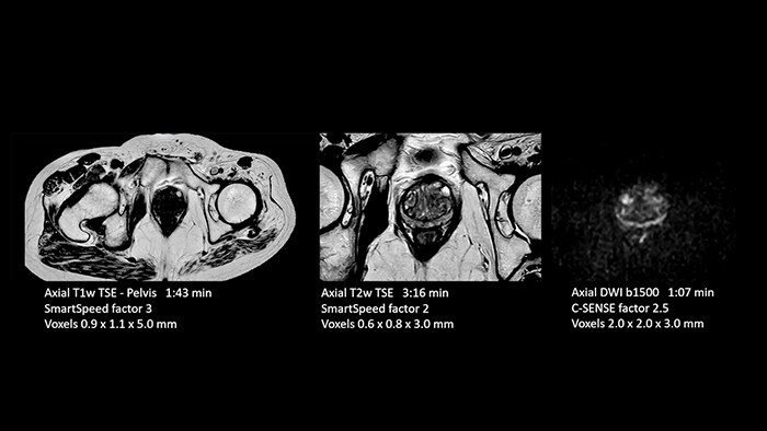 Prostate image one