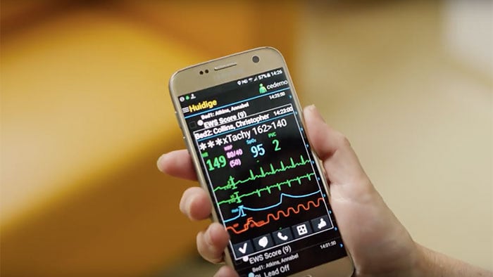 Using mobile devices to manage monitoring alarms with Philips CareEvent video