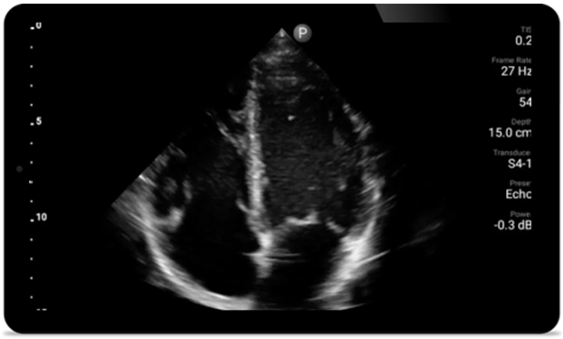 Third case image