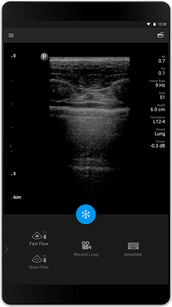 Lung exam