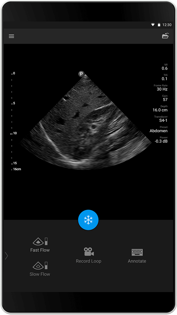 Abdomen exam S4-1